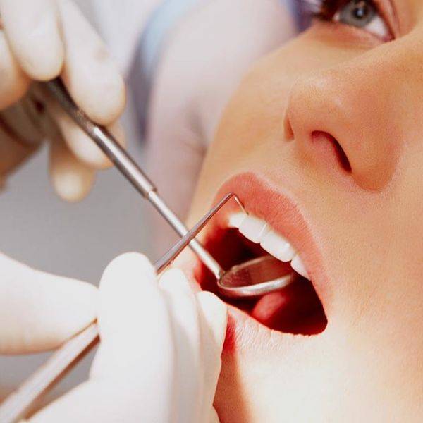 Close view of a dental exam inside an open mouth with metal instruments